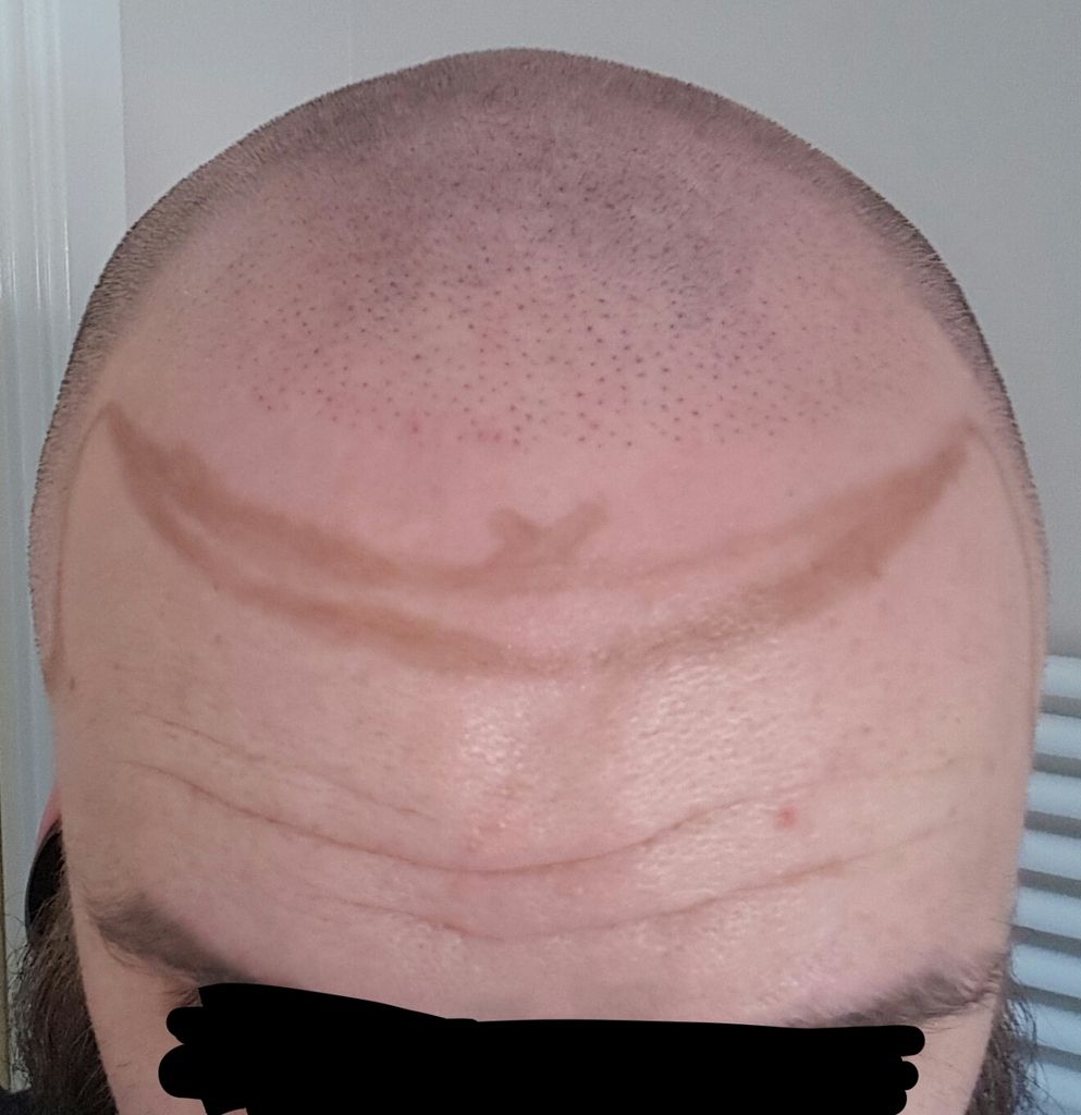 20170326_122826.jpg