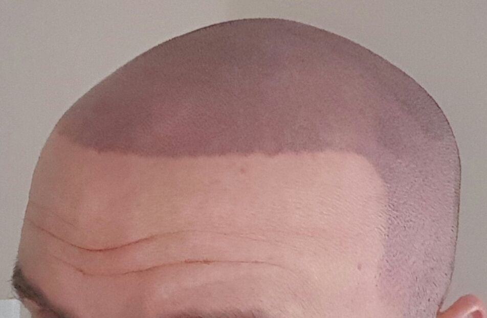 20170411_223817.jpg