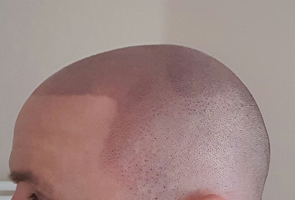 20170411_223907.jpg