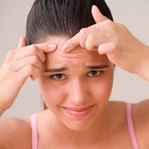 Prevent Pimple Scars