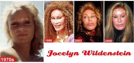 Jocelyn Wildenstein