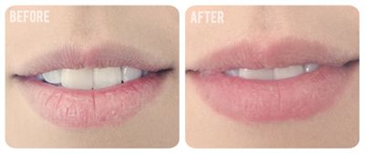 Lip Smoothie